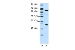 HMGB4 Rabbit anti-Human, Polyclonal, Novus Biologicals 0.1 mL | Buy Online | Novus Biologicals | Fisher Scientific